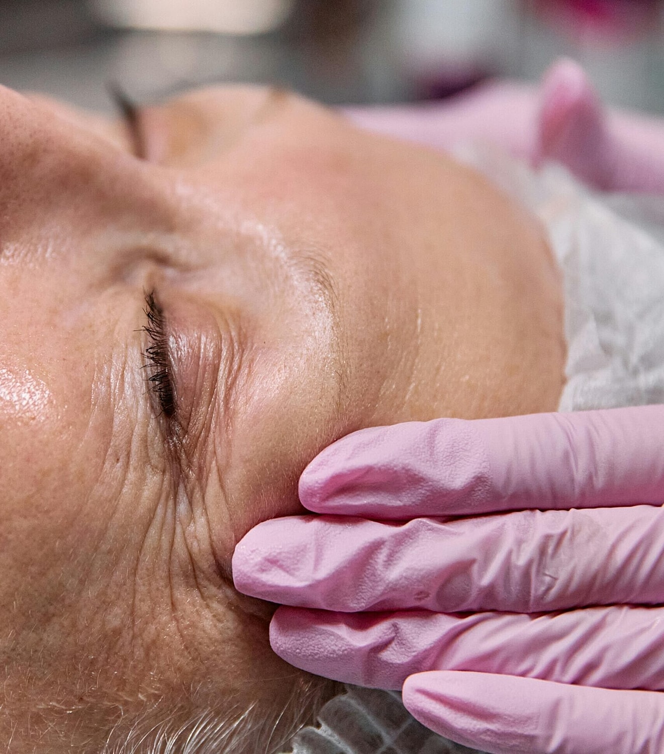 How much is eyelid surgery in Tampa?