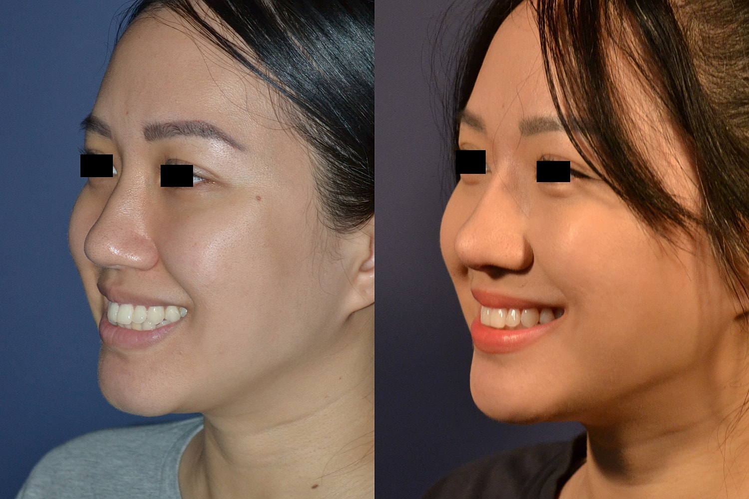 Before and after facial transformation comparison.