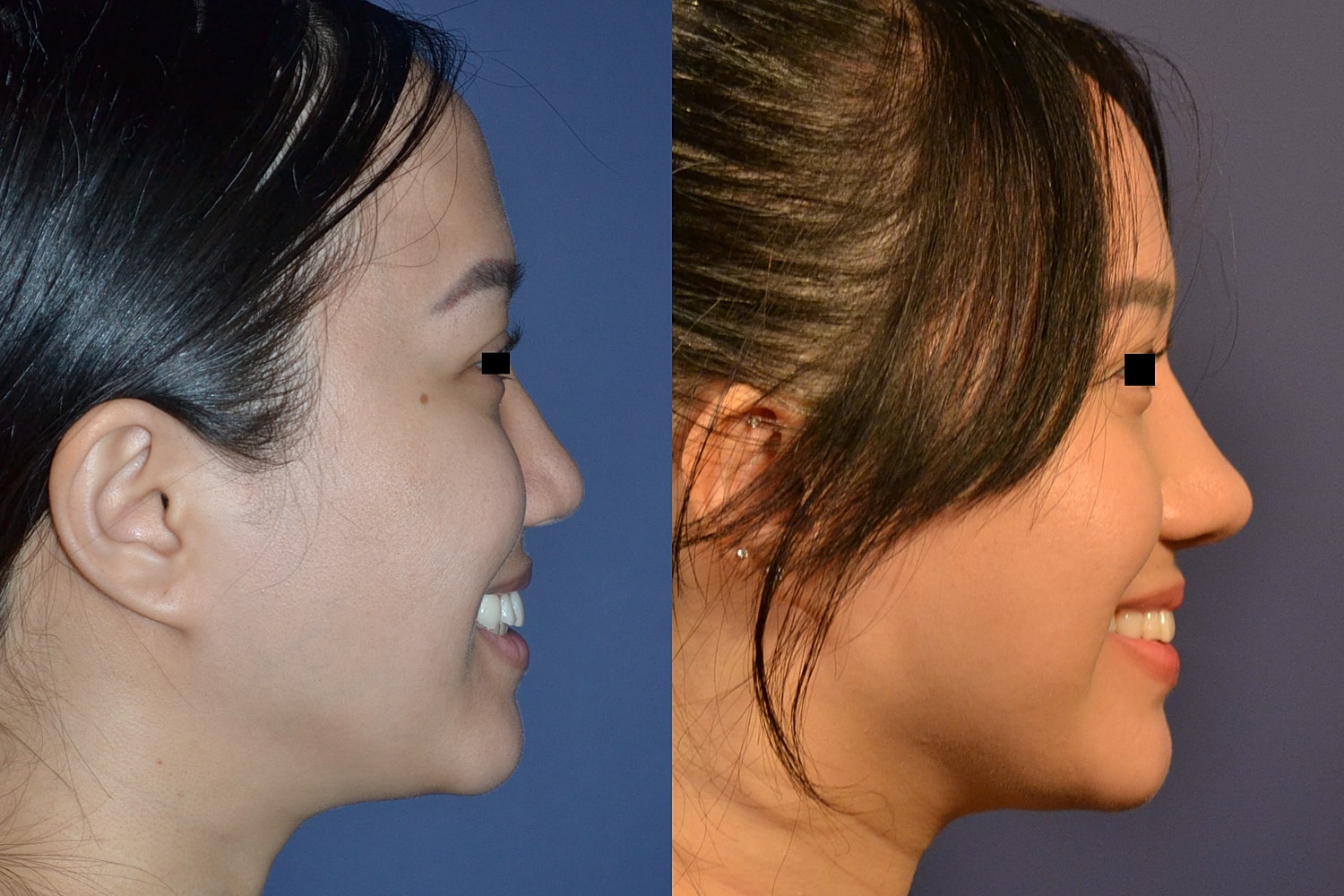 Profile comparison of facial features and expressions.