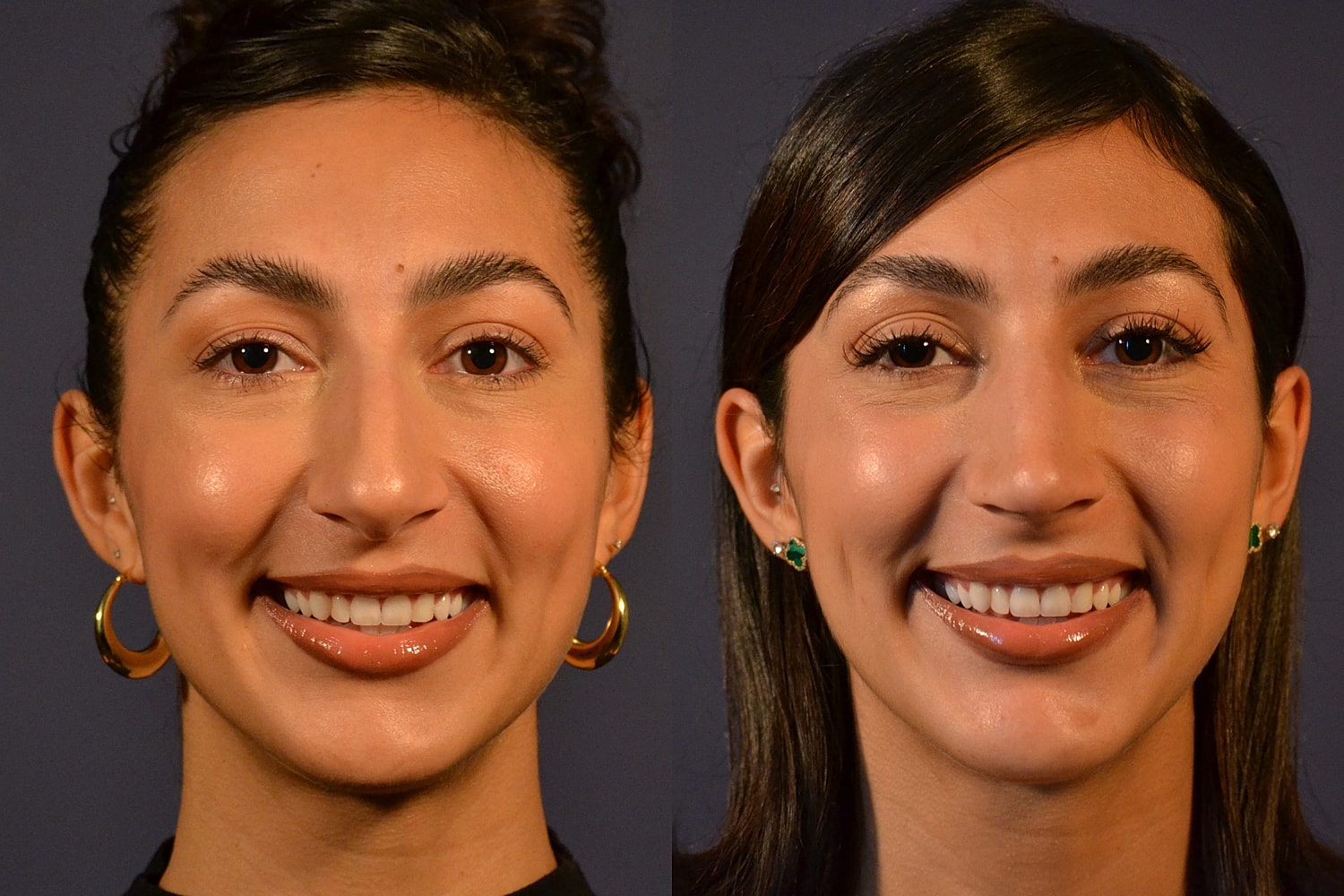 Two portraits of a smiling woman.