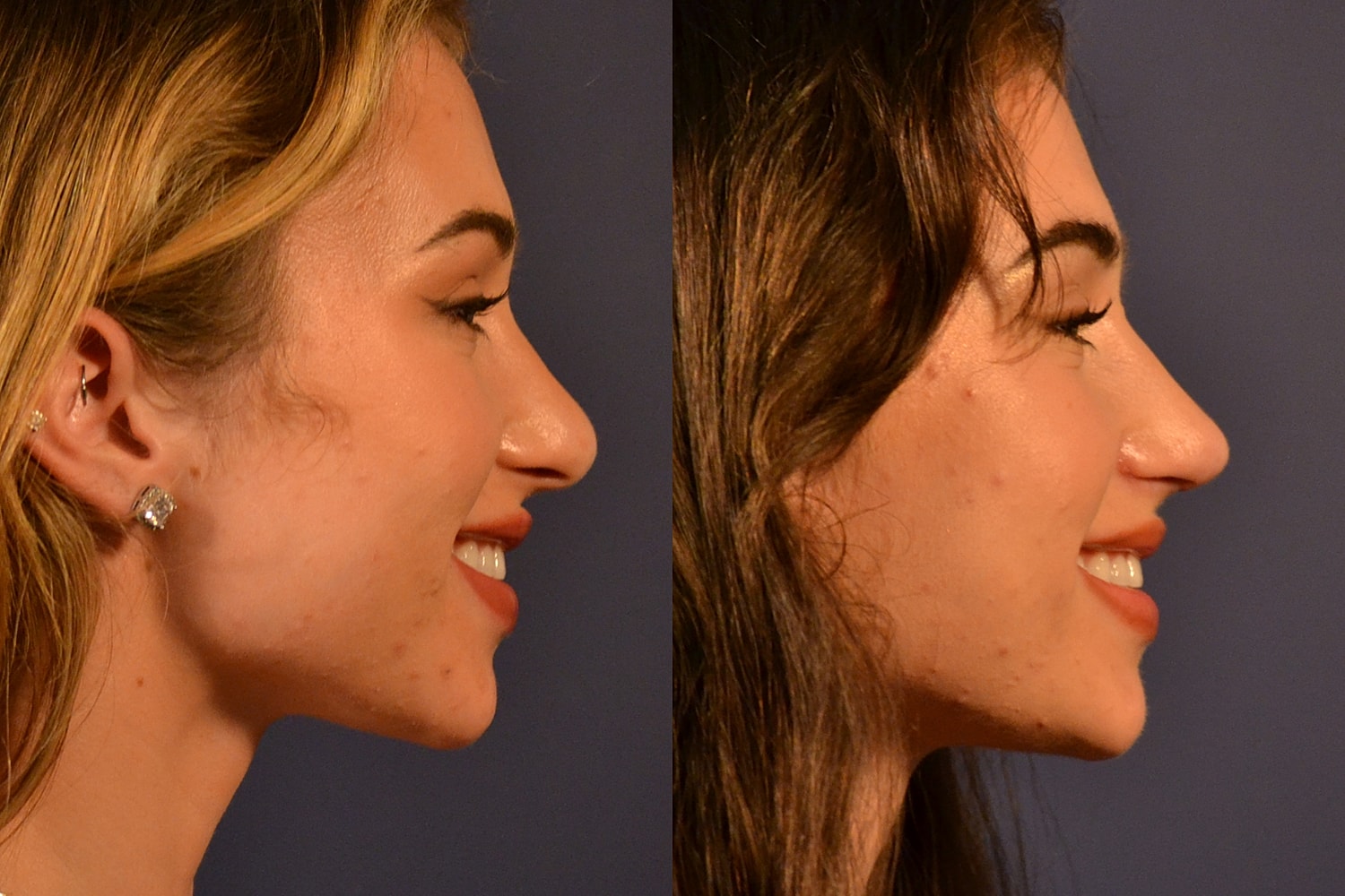 Profile comparison of two individuals smiling.