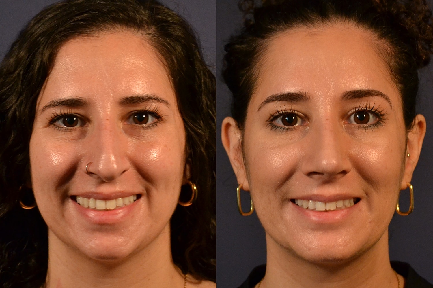 Two women smiling in side-by-side portraits.