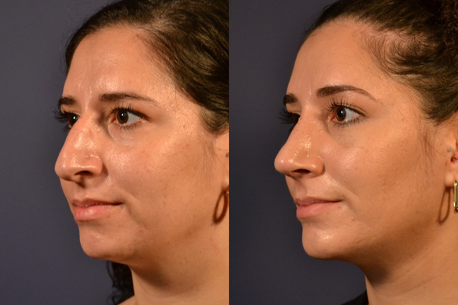 Side profile comparison of two individuals.