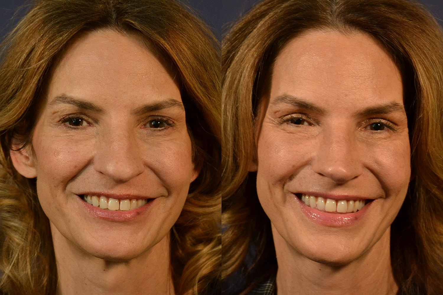 Side-by-side comparison of two smiling women.