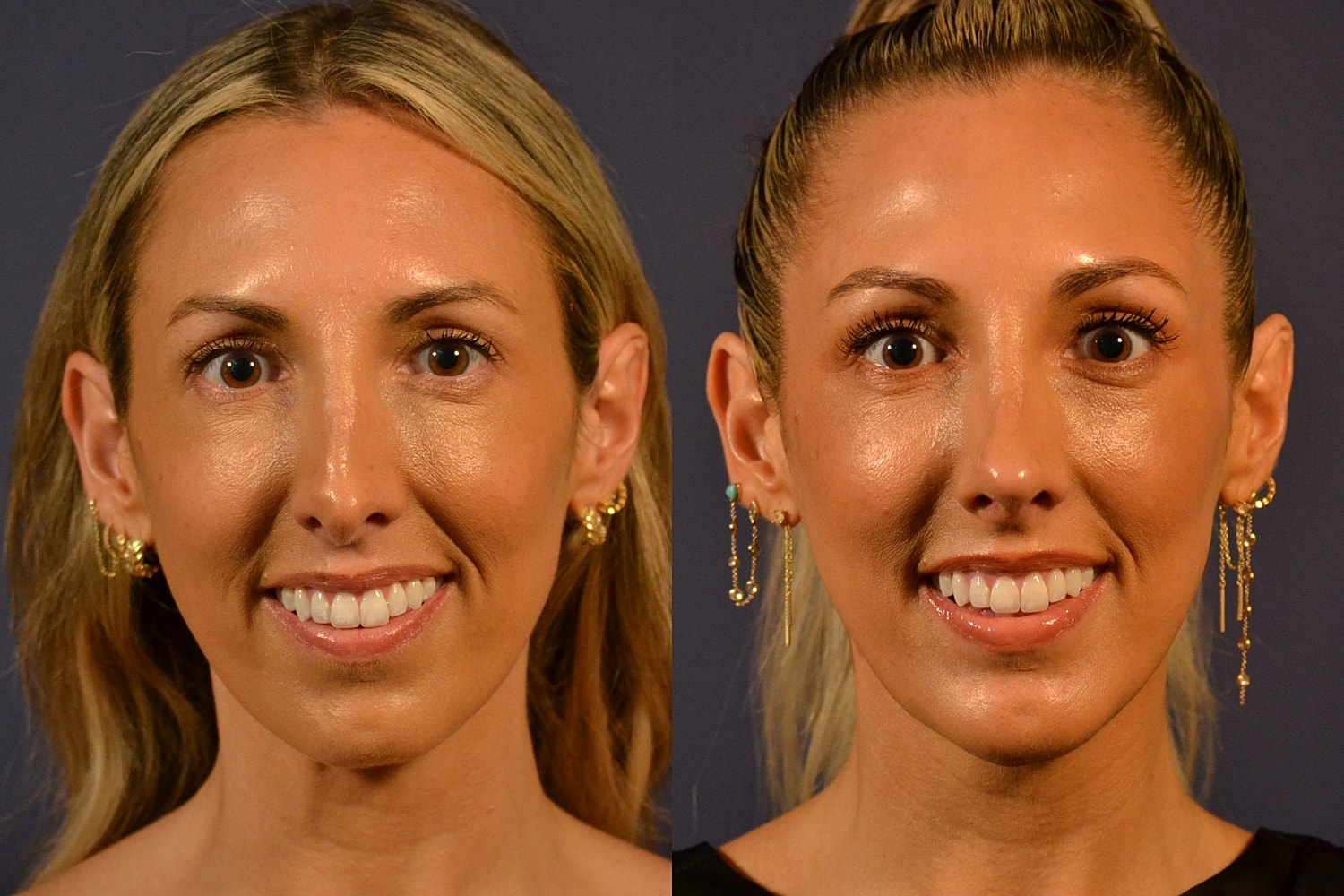 Comparison of two portraits of a woman.
