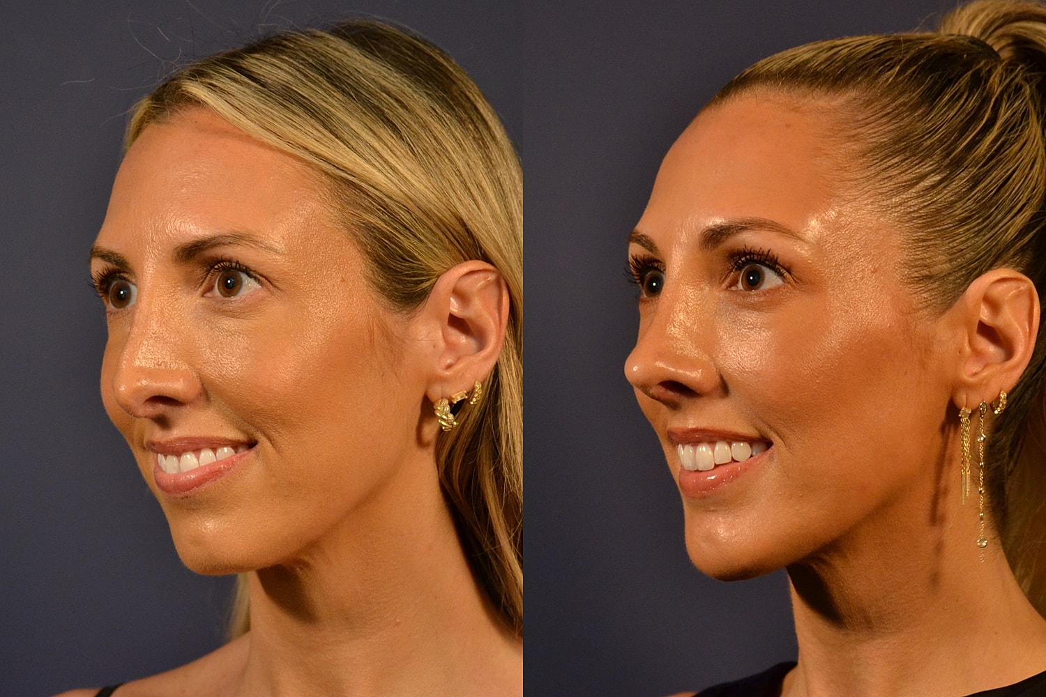 Profile portraits of a woman with earrings.