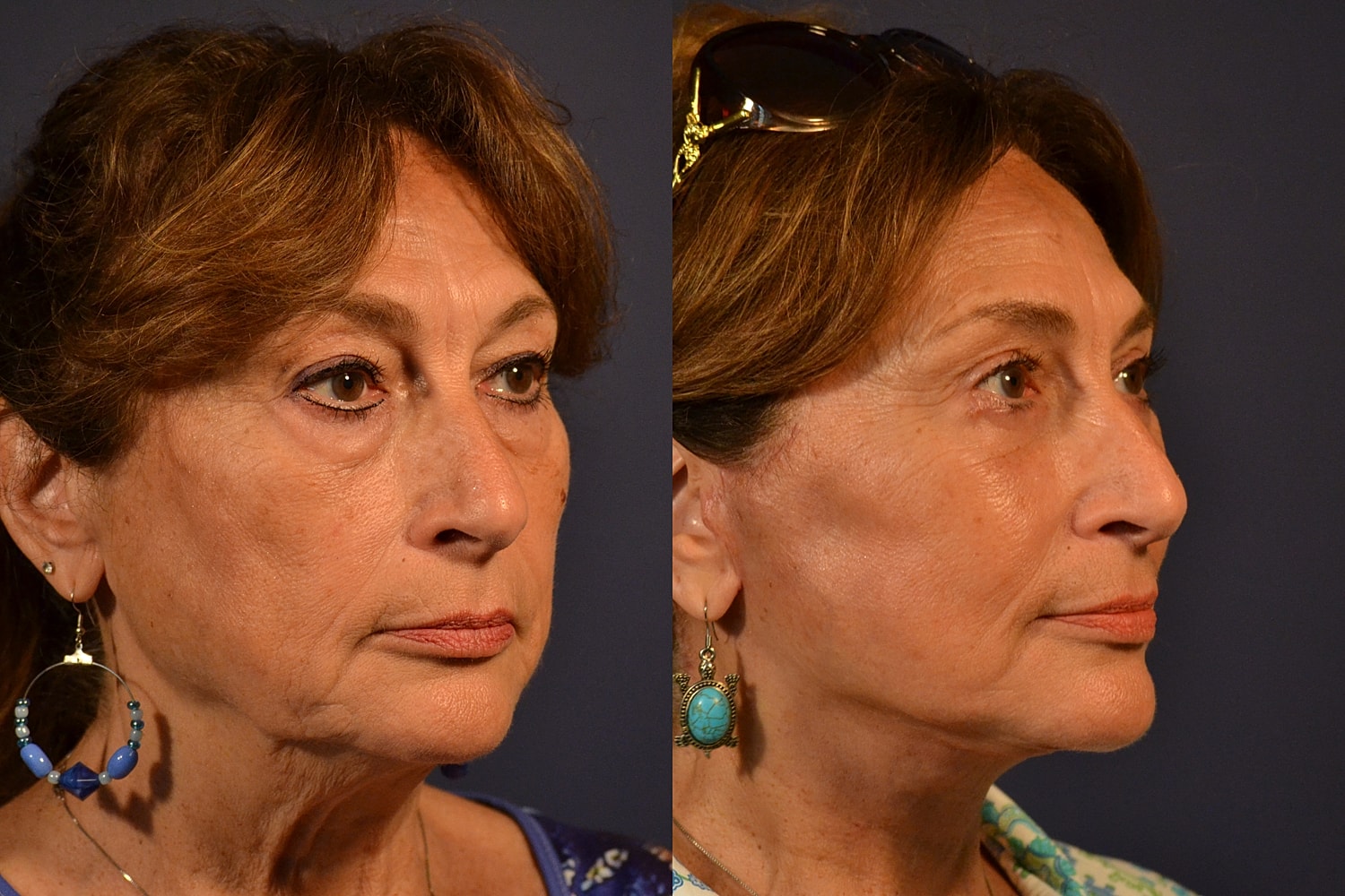 Profile portraits of woman with different hairstyles.